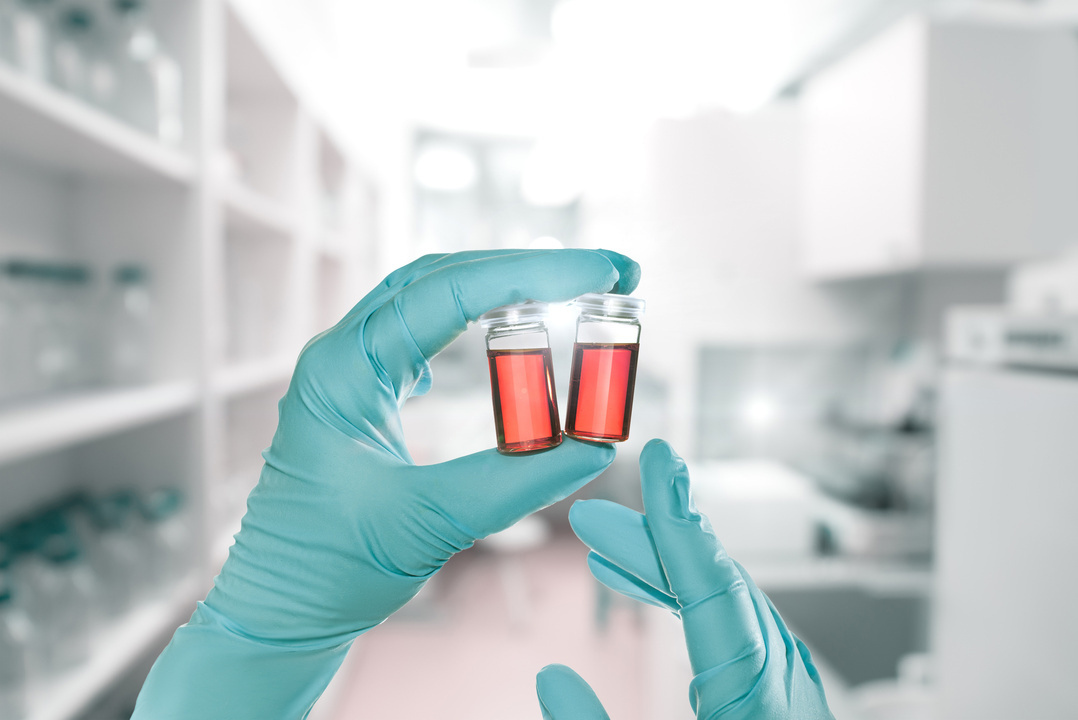 A person holding two small containers of blood.